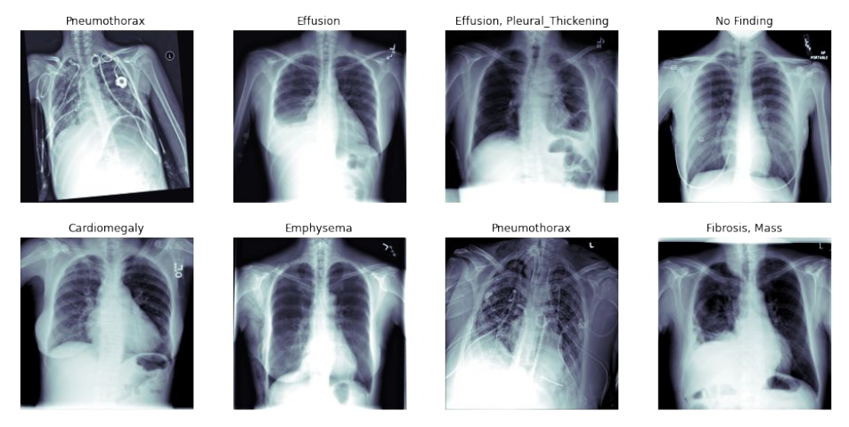 x-rays